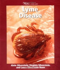 Image of Lyme Disease